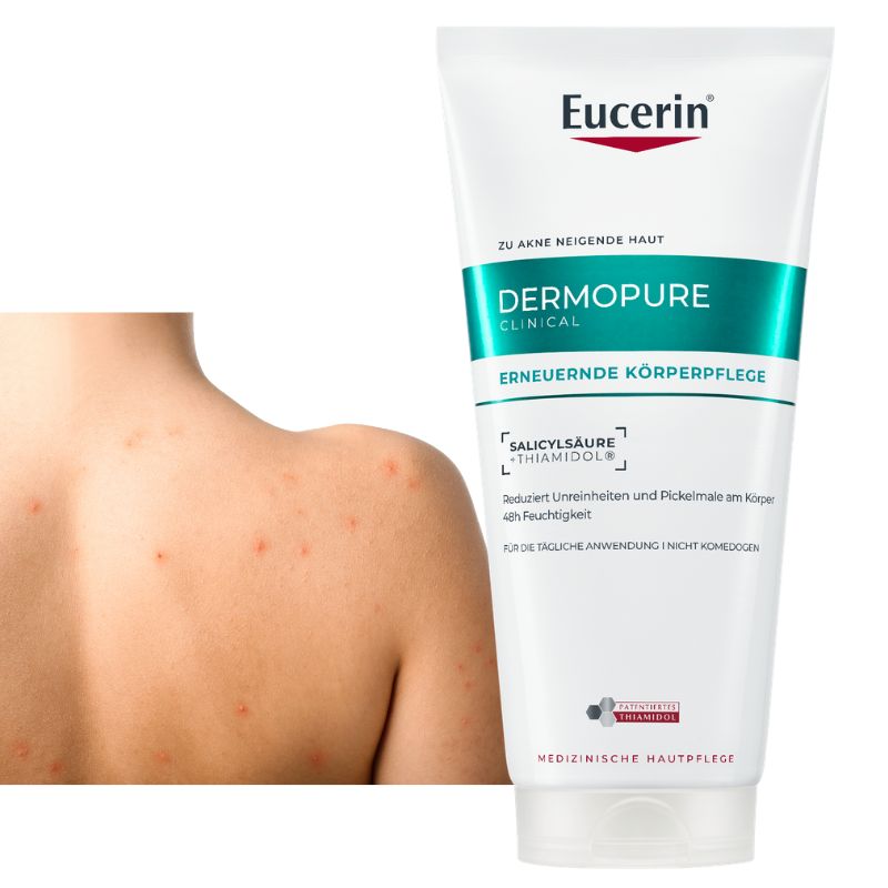 A tube of Eucerin Dermopure Clinical Eczema Relief body care cream stands against a white background, with a close-up inset of a person's shoulder showing red, irritated skin.