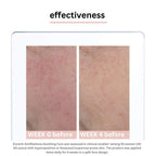 Eucerin antiedness megnyugtató gondozás 50 ml