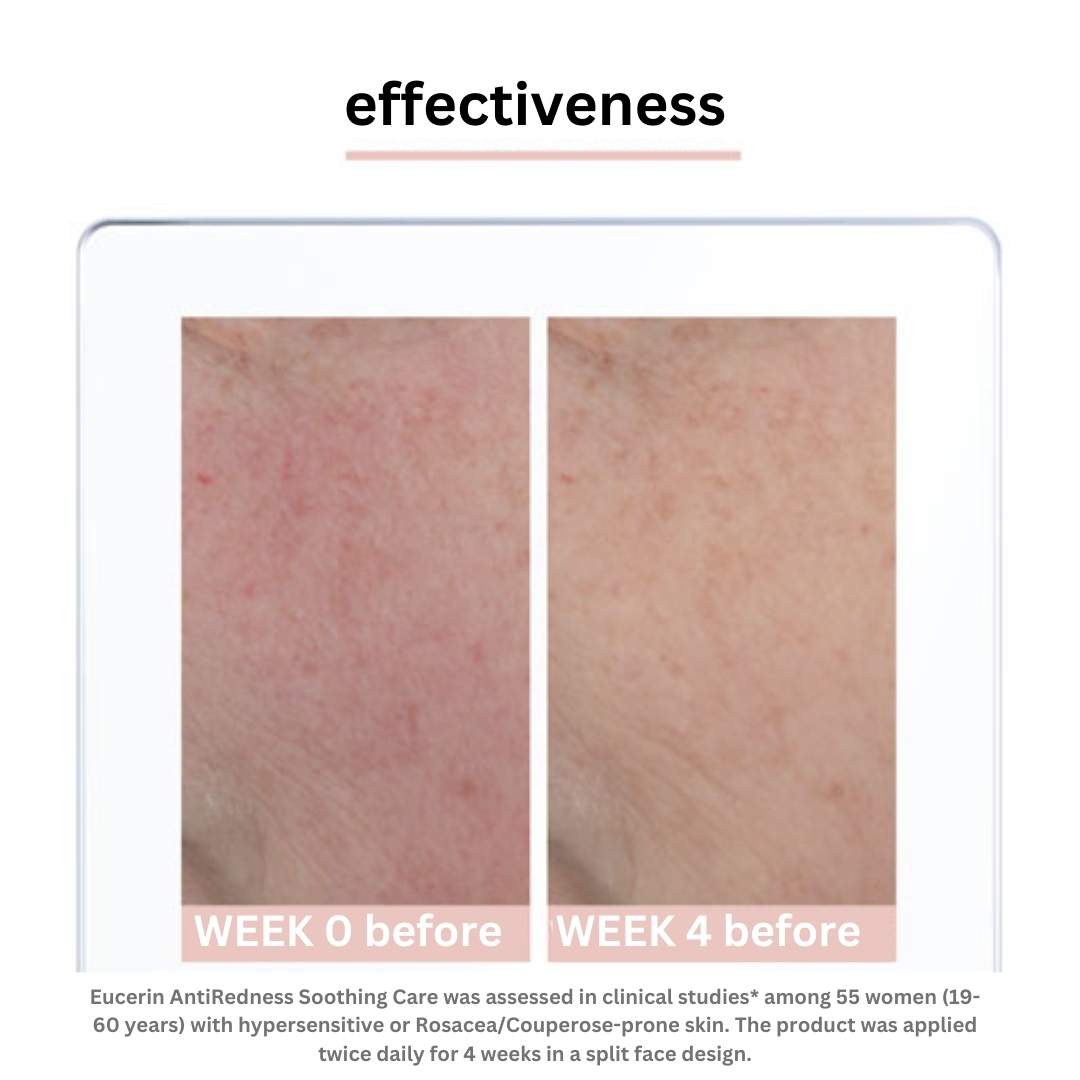 Eucerin antiedness megnyugtató gondozás 50 ml