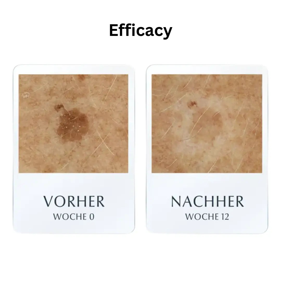 before and after results